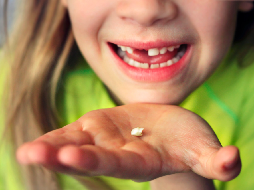 Os dentes de leite estão a cair? Aproveita para cuidar do sorriso do teu filho